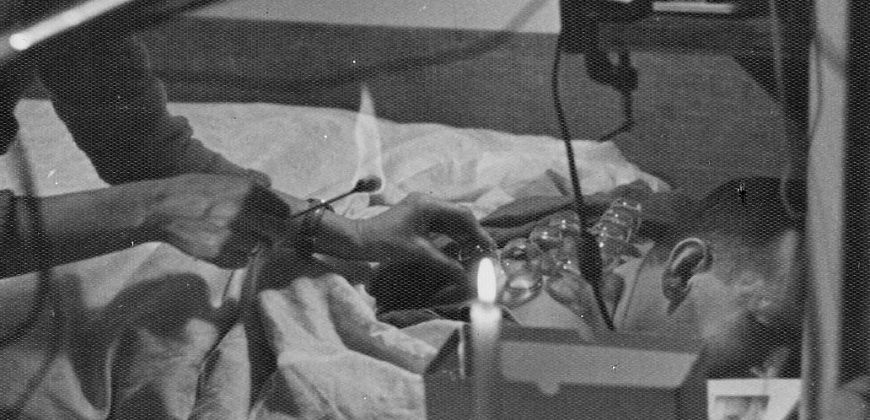 Fot. Z archowum Jerzego Lewczyńskiego, Zofia Beksińska stawiająca bańki Jerzemu Lewczyńskiemu